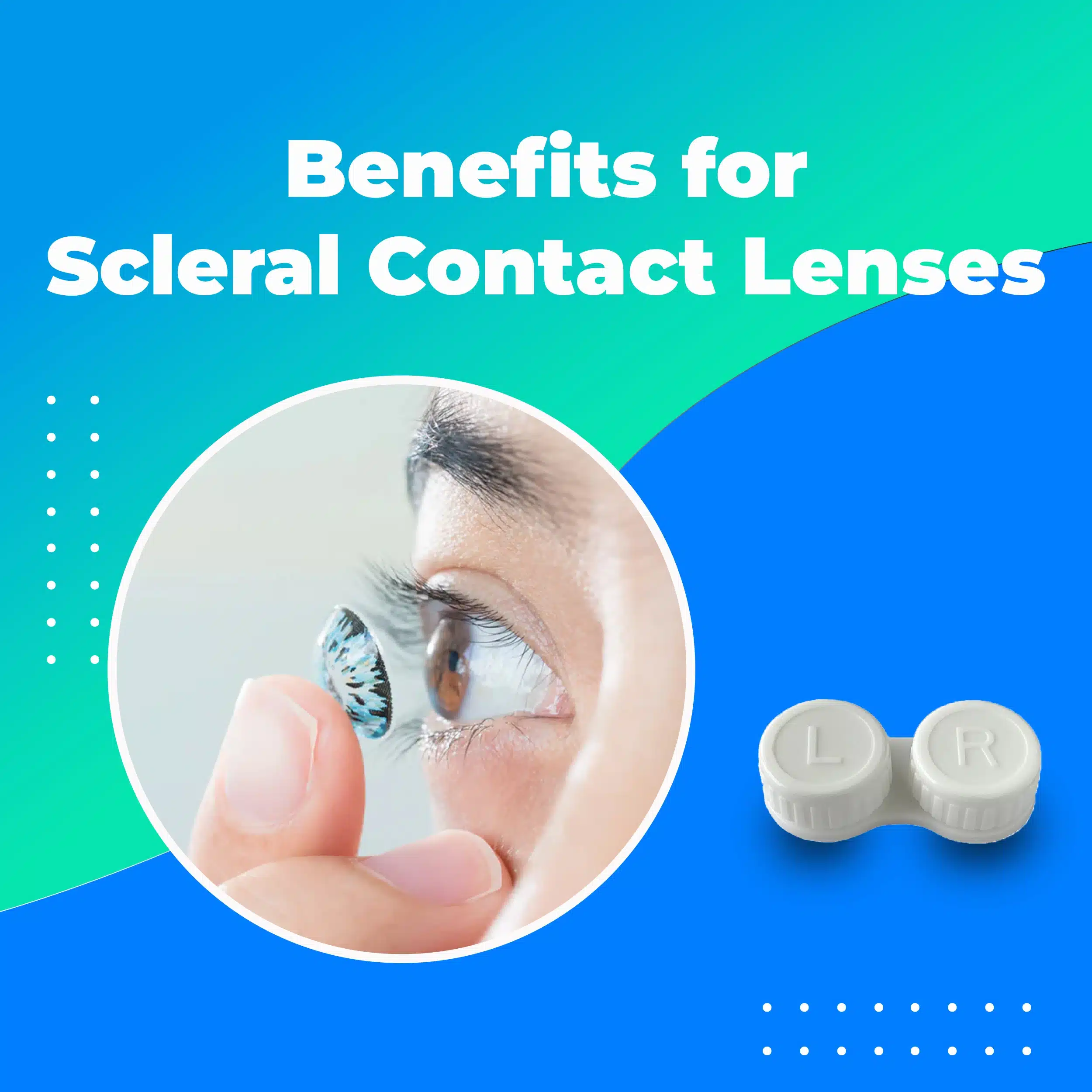 Scleral Contact Lens